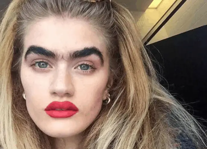 Thick unibrow